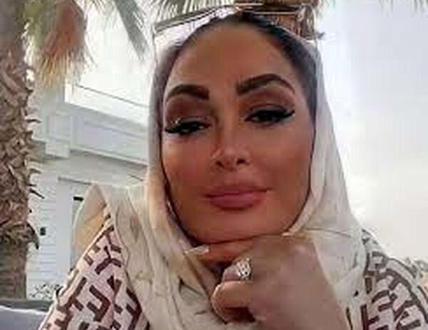 عکس زهره حمیدی بعد از عمل زیبایی