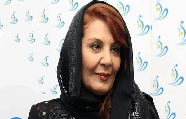 عکس زهره حمیدی بعد از عمل زیبایی