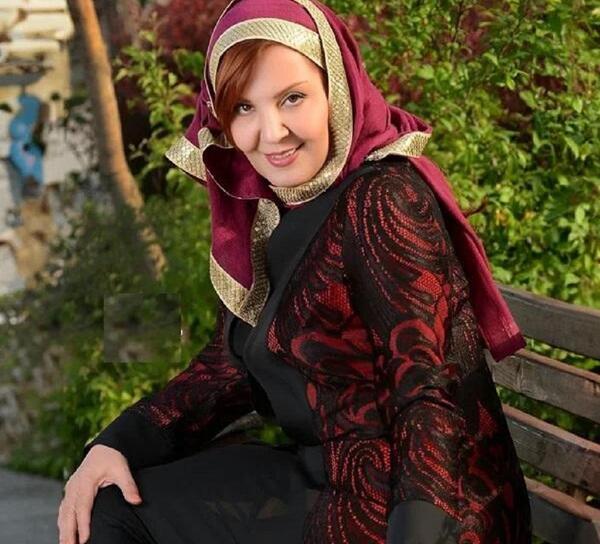 عکس زهره حمیدی بعد از عمل زیبایی