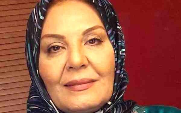 عکس زهره حمیدی بعد از عمل زیبایی