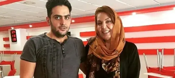 عکس زهره حمیدی بعد از عمل زیبایی