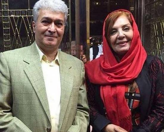 عکس زهره حمیدی بعد از عمل زیبایی