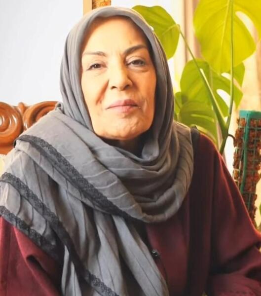 عکس زهره حمیدی بعد از عمل زیبایی