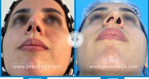 عکس دکتر حمید نوروزی چشم پزشک