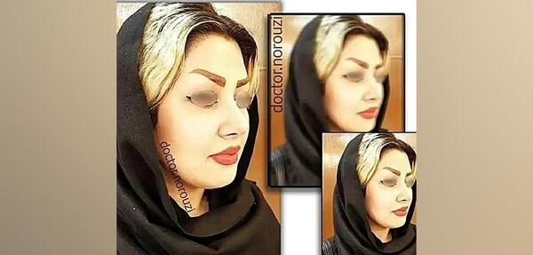 عکس دکتر حمید نوروزی چشم پزشک