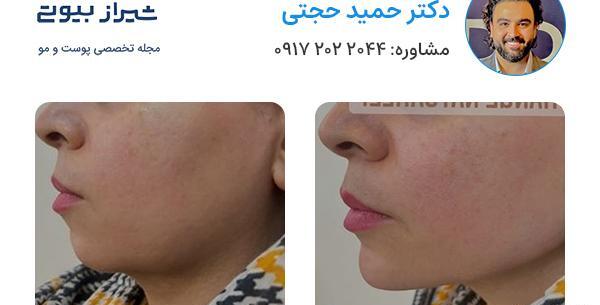 عکس دکتر حمید زارعی
