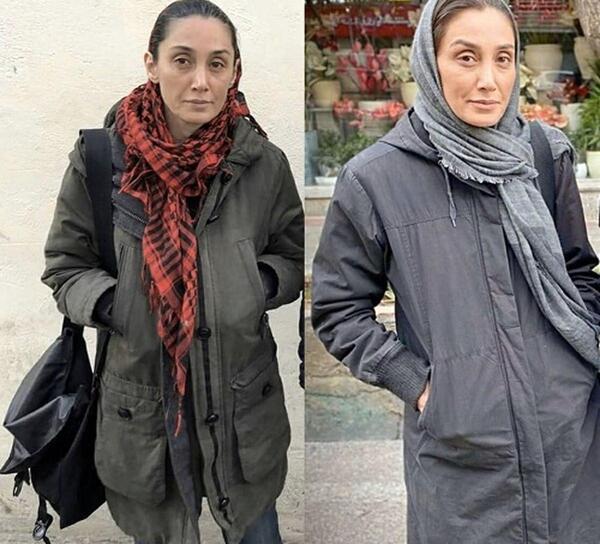 عکس هدیه تهرانی قبل از عمل بینی