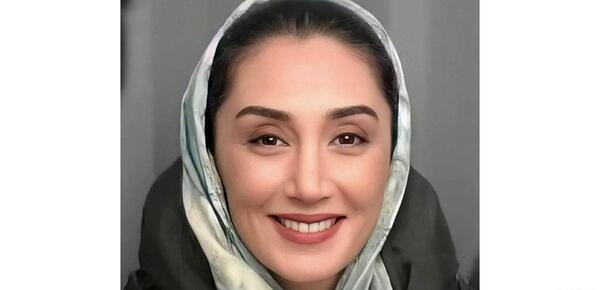 عکس هدیه تهرانی قبل از عمل بینی