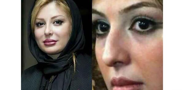عکس هدیه تهرانی قبل از عمل بینی