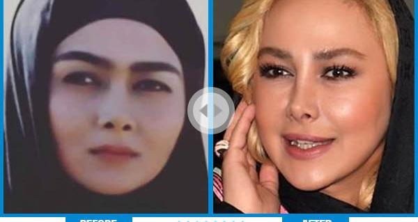 عکس هدیه تهرانی قبل از عمل بینی