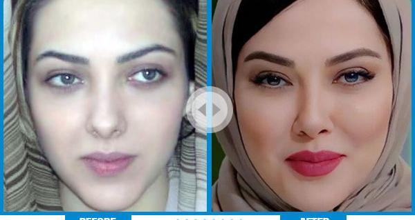 عکس هدیه تهرانی قبل از عمل بینی