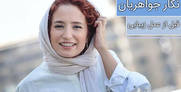 عکس هدیه تهرانی قبل از عمل بینی