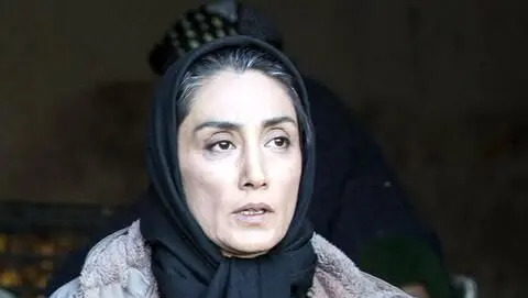 عکس هدیه تهرانی قبل از عمل