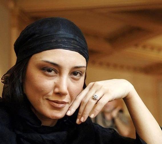 عکس هدیه تهرانی قبل از عمل