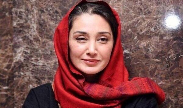عکس هدیه تهرانی قبل از عمل