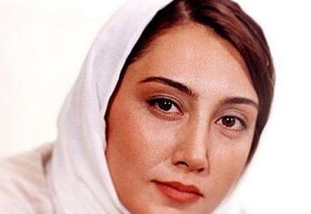 عکس هدیه تهرانی قبل از عمل