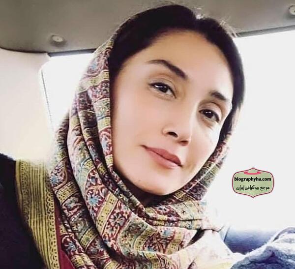 عکس هدیه تهرانی قبل از عمل