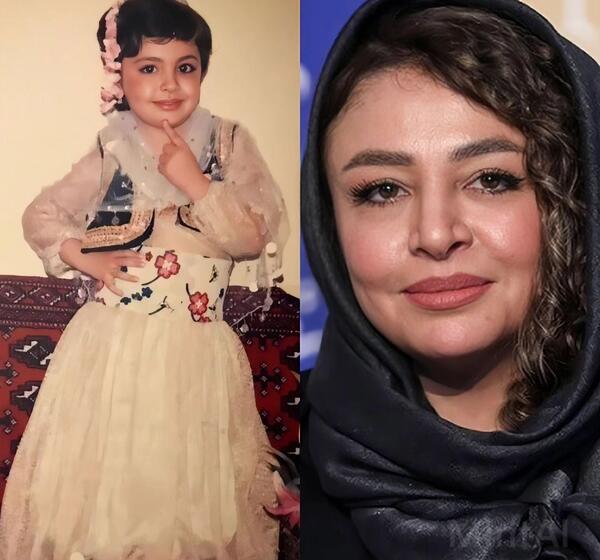 عکس های مه لقا جابری قبل عمل