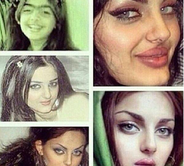 عکس های مه لقا جابری قبل عمل