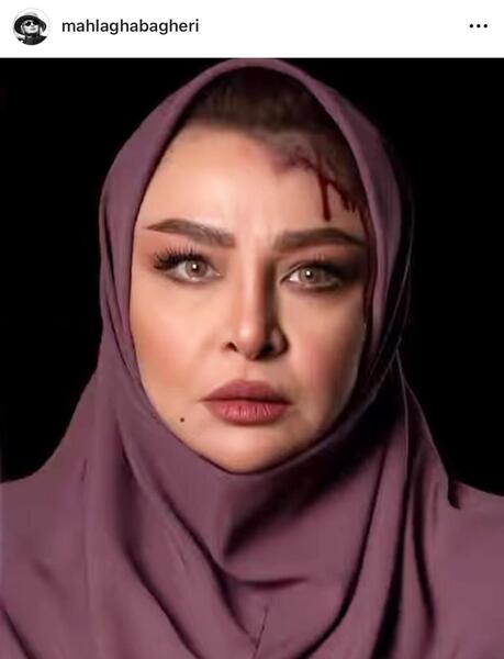 عکس های مه لقا جابری قبل عمل
