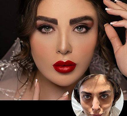 عکس های مبینا دندون