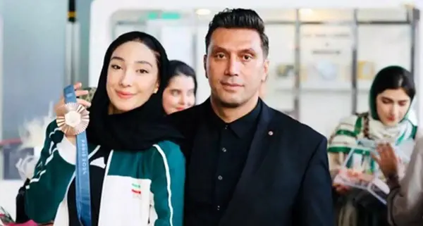 عکس مبینا نعمت زاده قبل عمل