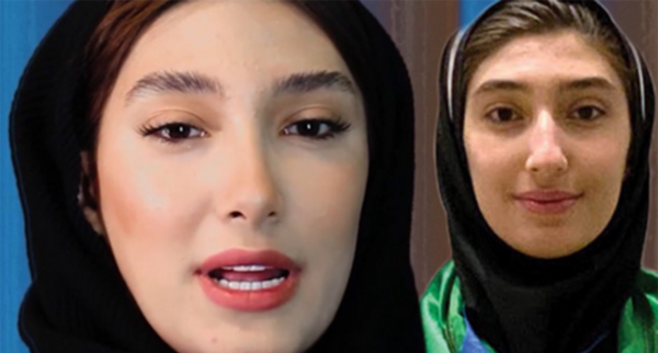 عکس مبینا نعمت زاده قبل عمل