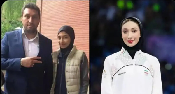 عکس مبینا نعمت زاده قبل عمل