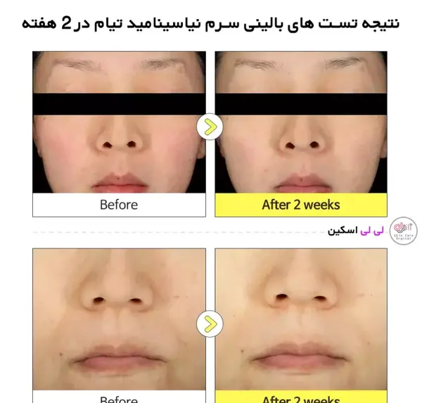 عکس تیام بلاگر