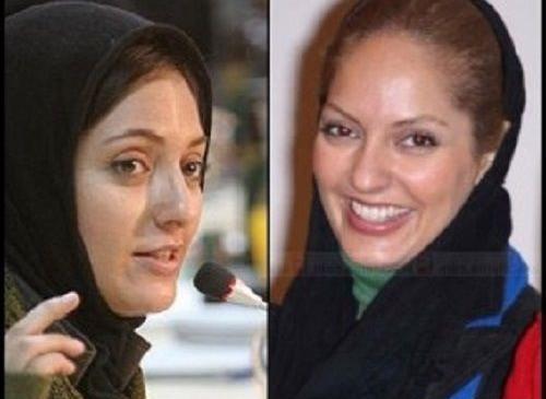عکس هانیه توسلی قبل از عمل بینی