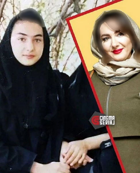 عکس هانیه توسلی قبل از عمل بینی