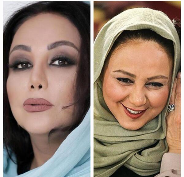 عکس هانیه توسلی قبل از عمل بینی