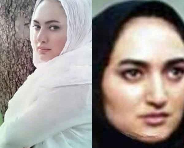 عکس هانیه توسلی قبل از عمل بینی