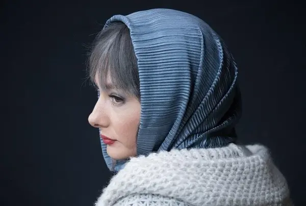 عکس های هانیه توسلی قبل از عمل بینی