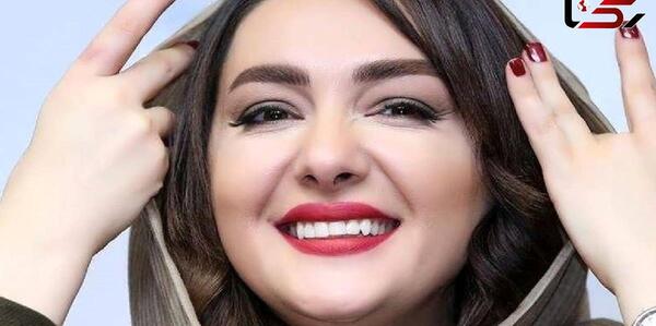 عکس های هانیه توسلی قبل از عمل بینی