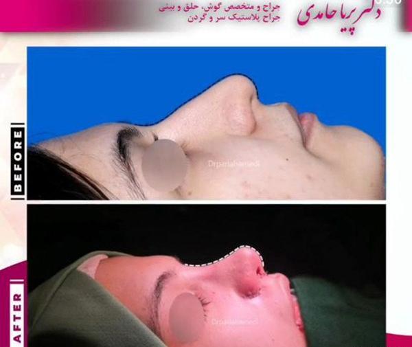 عکس های پریا حامدی