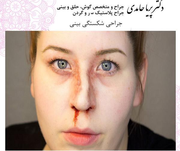عکس پریا حامدی جدید