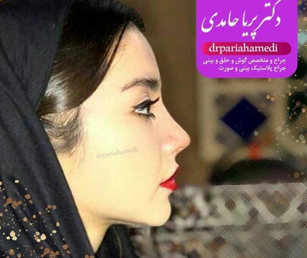 عکس پریا حامدی جدید
