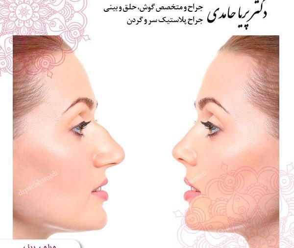عکس های جدید پریا حامدی
