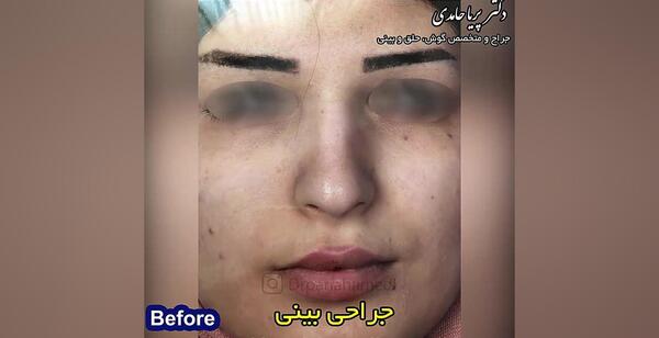 عکس تولد پریا حامدی