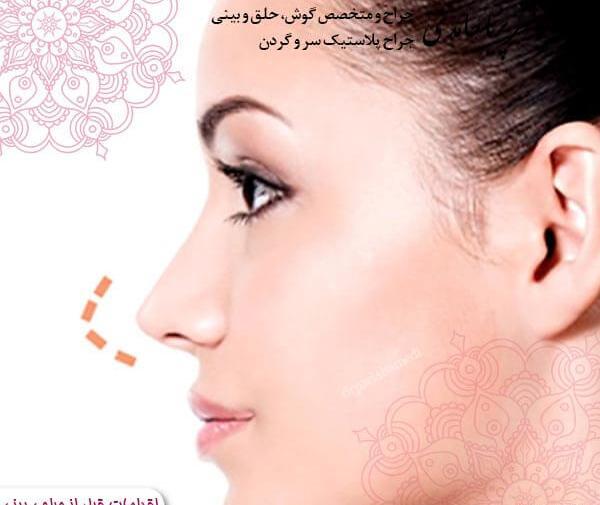 عکس پریا حامدی بدون ارایش
