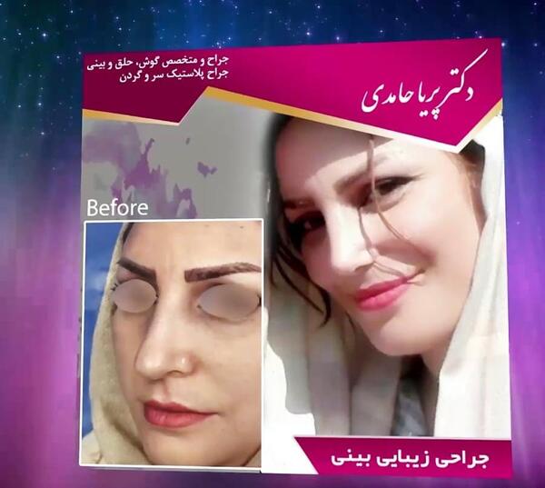 عکس پریا حامدی بدون ارایش