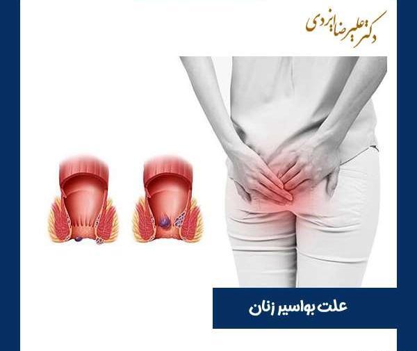 عکس بواسیر در زنان