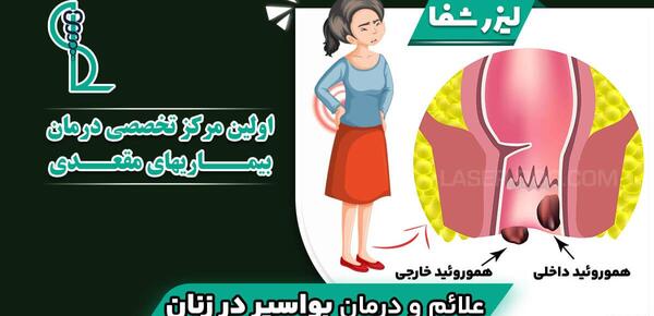 عکس بواسیر در زنان