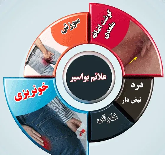 عکس بواسیر در زنان