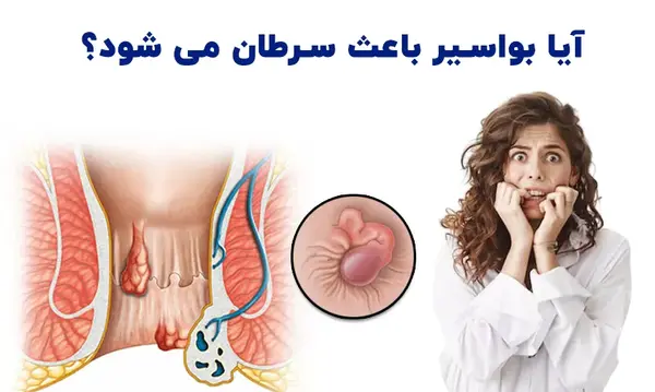 عکس بواسیر در زنان