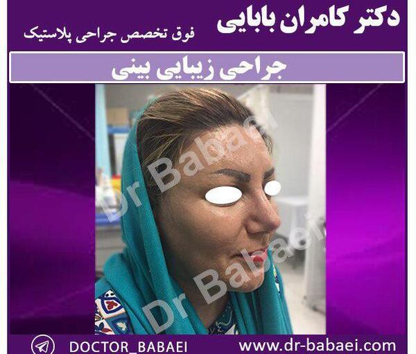 عکس بابایی خوشگل