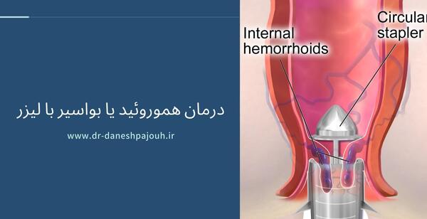 عکس باباسیل خارجی