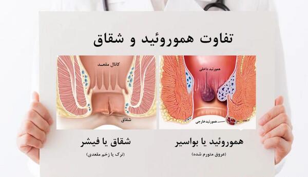 عکس باباسیل خارجی