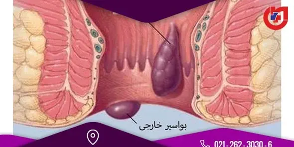 عکس باباسیل خارجی